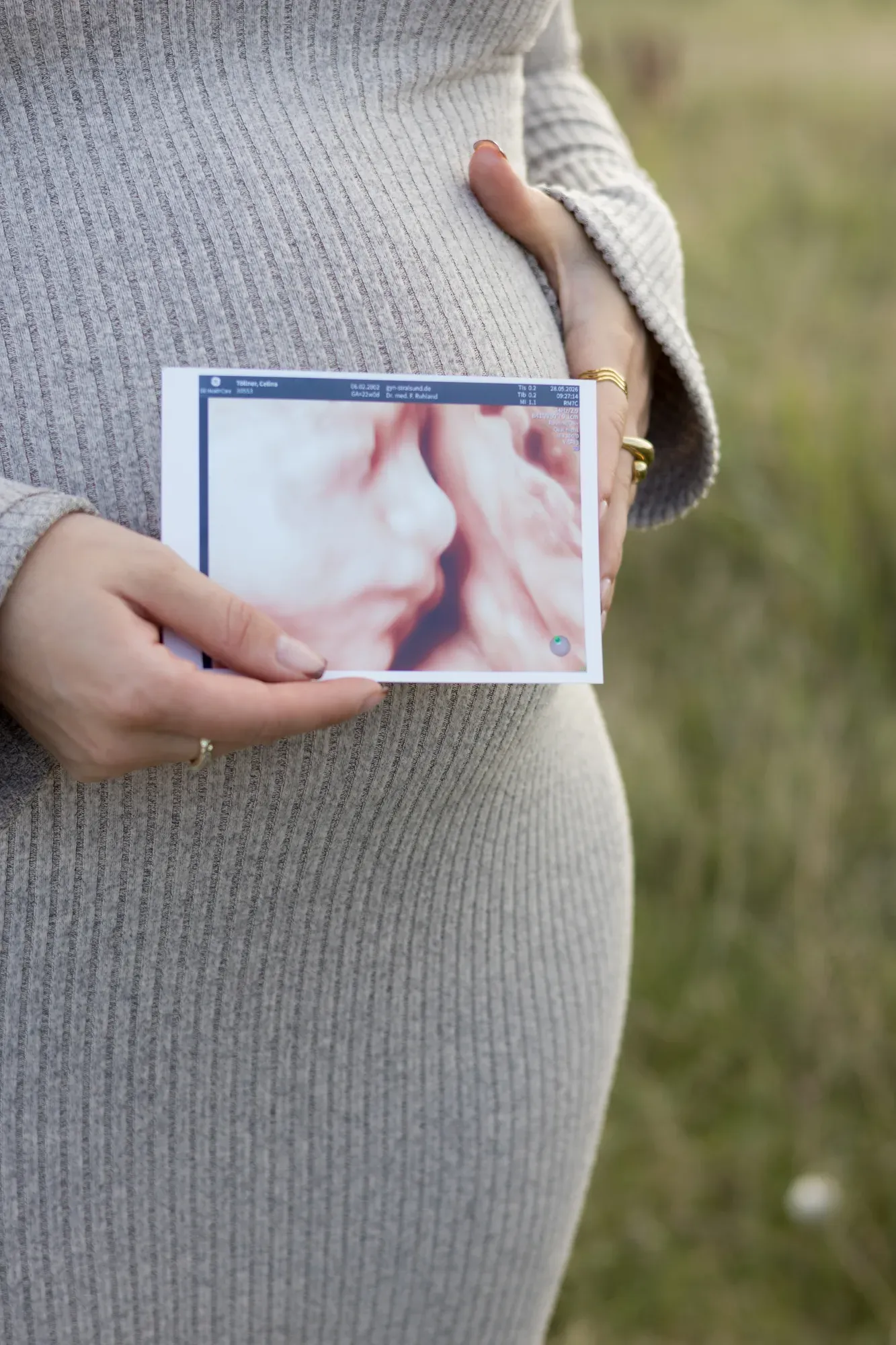 Detail: Hände halten ein Ultraschallbild an den Babybauch im grauen Strickkleid