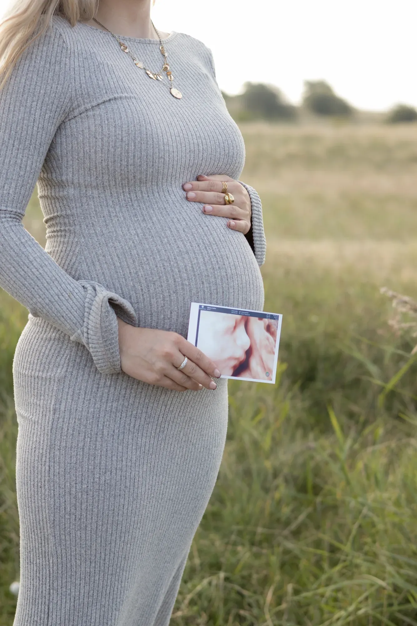 Schwangere im grauen Strickkleid hält ein Ultraschallbild vor den Babybauch